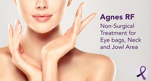 Agnes RF - St. Charles County Dermatologic Surgery