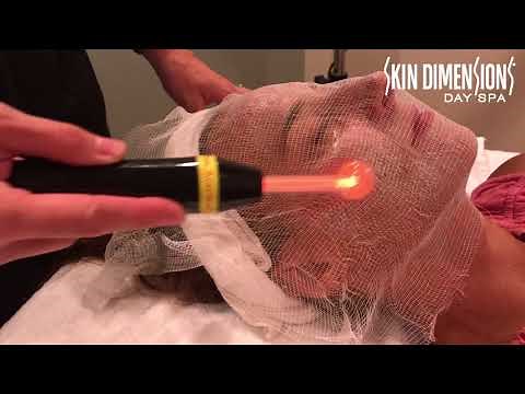 High Frequency Treatment at Skin Dimensions Day Spa