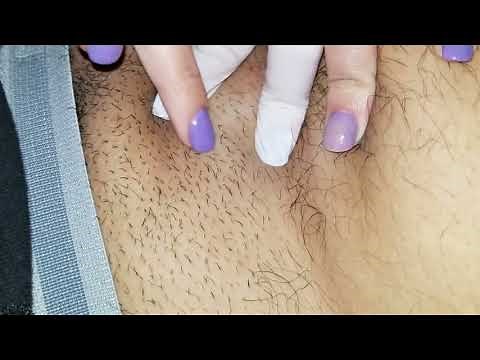 Pimple on Vagina 😸|Vagina.