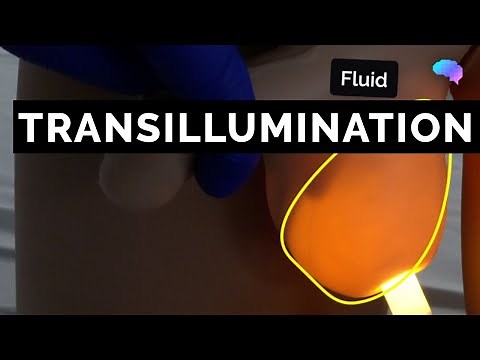 Transillumination | Scrotal Examination - OSCE Guide | UKMLA | CPSA | PLAB 2