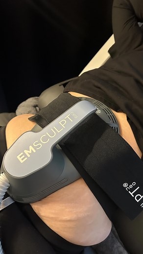 BURN BABY BURN 🔥 EMSCULPT NEO is a non invasive body contouring treatment that builds muscle and burns fat by inducing muscle contractions with electromagnetic energy!! BOOK NOW! 📞 Call: (617) 668-1239 🌐 Book online: aestheticmindmd.com 📍 Visit us: 332 Washington St, Wellesley MA 📧 support@aestheticmindmd.com 💳 0% Interest Payment Plans Available ⸻ #emsculptnearme #fatburningboston #wellesleygym #emsculptneo #emsculptboston #emsculptnatick #fatburningtreatmentboston #aestheticmindmd #natic