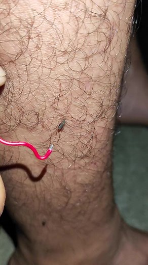 Exploring the Wonders of Mosquito Habitats #mosquito #mosquitoes #gnats #biting #itchy #summer #outdoors #bugspray #bugbite #pestcontrol #insect #nature #health #irritating #annoying #swarm #flying #disease #vector #malaria #dengue #zika | Lexus Pet Boutique