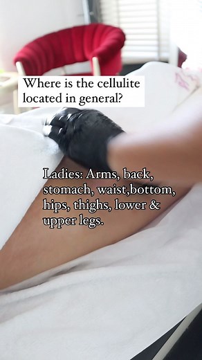 Anyone can develop cellulite, regardless of size. It occurs as a...
