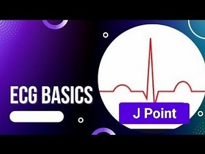 ECG Basics | J Point | J Point abnormalities |