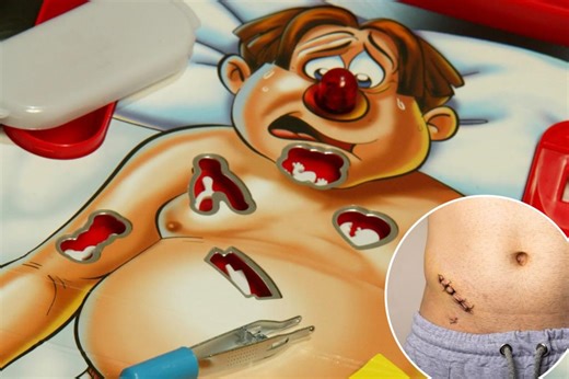 10 organs you can actually live without — including ‘the body’s initial food blender’ and one that’s ‘largely useless’