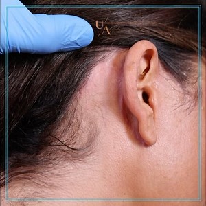 13K views · 15 comments | 良Most patients are scared of the possible...