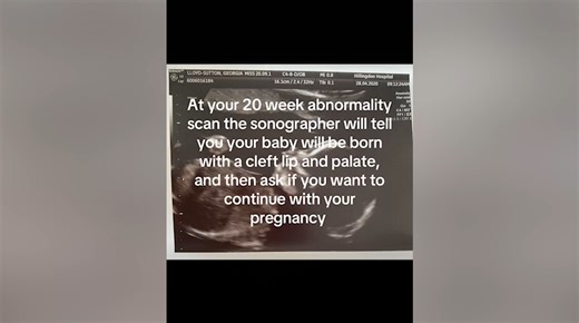 Woman told daughter has abnormality at 20 week scan, update now melts hearts