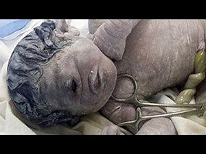 Cyclops Baby Born In Egypt