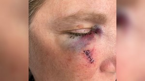 One injured as family reunion disrupted by surprise wind event in Uintas - KSLTV.com