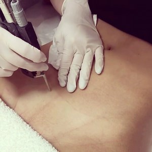 1.3K views | •Do you suffer from ingrown hairs and bumps in your...