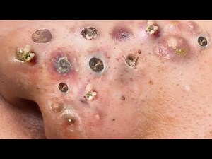 Relaxing Every Day With SKY SPA # 44