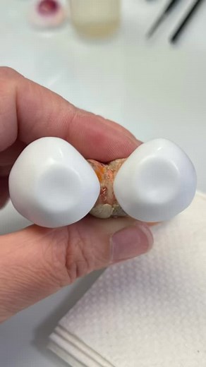 It came in a dream. #statue #turnto #gold #prosthetics #blindness #eyehealth | Center for Ocular Prosthetics