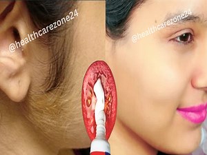 393K views · 3.6K reactions | Stop Shaving! Easy way to remove body and public hair without pain | Health Care Zone | Facebook