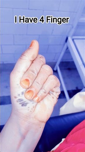 4 Finger club #viralvideo