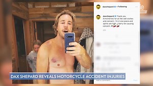 Dax Shepard Suffers Multiple Broken Bones in Motorcycle Accident: 'I Need Surgery'