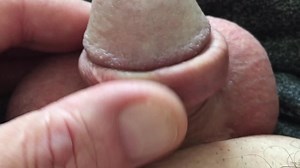 Foreskin and urethral dilation, urethral sounding