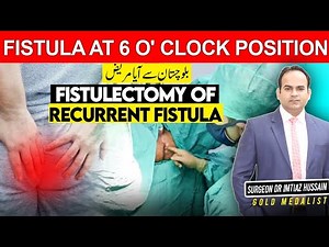 Fistulectomy of Recurrent Perianal Fistula in a Patient from Balochistan | Surgeon Dr Imtiaz Hussain