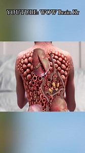 ASMR Remove dog tick, Maggots and Cysts from infected Back #asmr #asmrsound #treatment #removal #dogtick #maggot | WOW Brain