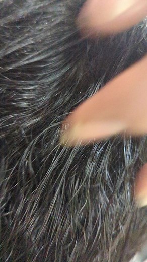 3.5K views · 19 reactions | Services Name - KERA BLAST....