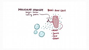 Strep Throat Can Lead To Heart Complications | Cardiology