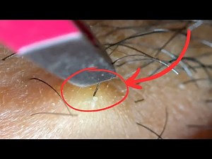 The Most Satisfying Hair Pull Compilation Ever