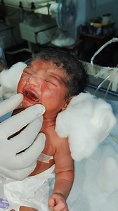 4K views · 23 reactions | Cute baby so sleep beautiful chik in nicu  #nursing #skills #youtubeshorts #movieclips #cutebaby #reelsvideoシ #foryoupageシforyou #viralvideo2025シ #fbreelsfypシ゚ #followersreels #fbreels2025ツ | Talim Tigers Talim Tigers | Facebook