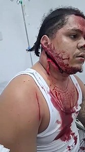 Man Slashed In The Face During Fight