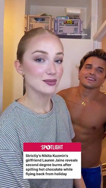 Strictly star's girlfriend reveals horrific second degree burns
