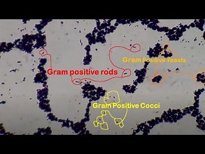Gram positive cocci, rods and yeast cells under the Microscope