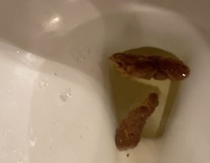 Bonus Evening Logs with Fart