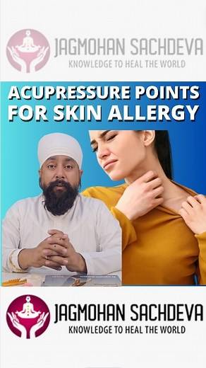 Severe Allergies Can Be Cured Through Acupressure || Jagmohan Sachdeva #Acupressure #AcupressureTraining #allergies #allergy #health #foodallergies #allergyseason #allergyawareness #eczema #allergyrelief | ACUPRESSURE THERAPY