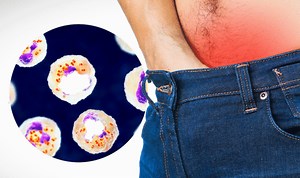 Gonorrhoea: The facts and how to prevent the infection