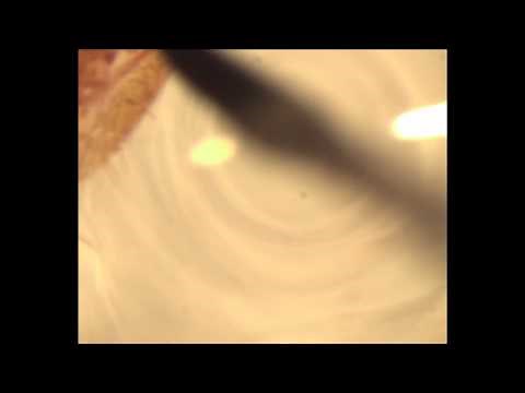 Dissection of khapra beetle larvae