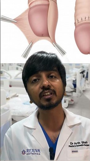 What is Circumcision Surgery?