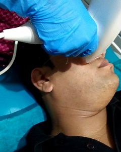 Venus viva is an advanced,non surgical solution for skin resurfacing that works to improve the overall texture #drapratim #cutisskinsolution #cutisglow #venusviva #scars #acnescars #acne #lines #wrinkles#acnerosacea #skincare #treatments #dermatology | Cutis Skin Studio