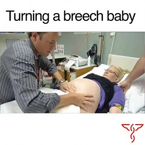 1.4K views · 12 reactions | This video shows an external cephalic...