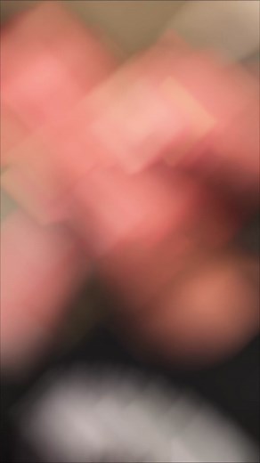 Epic Pimple Extraction Compilation You Need to See