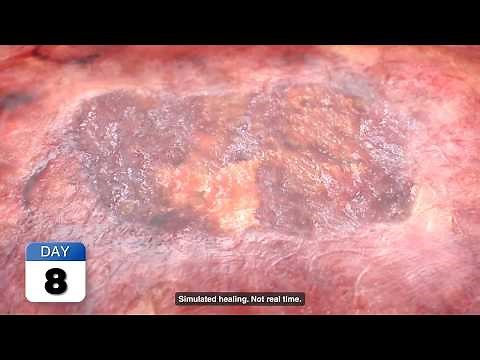 TISSEEL Fibrin Sealant Mechanism of Action