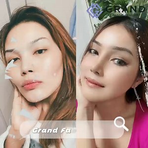 Amazing transformation with Grand Plastic Surgery🥰❣ From large, irregular facial line to soft, feminine and beautiful facial line! ⚜Contact here for inquiry⚜ ☑️Tel: ( 82) 70-7119-1580 ☑️Mobile: ( 82) 10-9132-6546 (Whatsapp, Line, Kakaotalk, Viber, iMessage) ☑️Email: grandps.en@gmail.com ☑️Facebook: Grand Plastic Surgery, Korea ☑️Website: eng.grandsurgery.com ☑️Pinterest : https://www.pinterest.co.kr/grandps_eng/ ☑️Tumblr: http://grandsurgery.tumblr.com/ ☑️Instagram: grandps_eng ☑️Blogger: http: