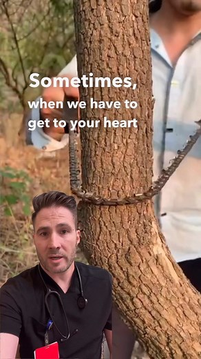 Dr. Joe, M.D. on Instagram: "A Gigli saw is a flexible wire saw used by surgeons for bone cutting. A Gigli saw is also often used for amputation, where the bones have to be smoothly cut at the level of amputation. #surgery #emergency #premed #prenursing #medstudent #nursingstudent #doctor"