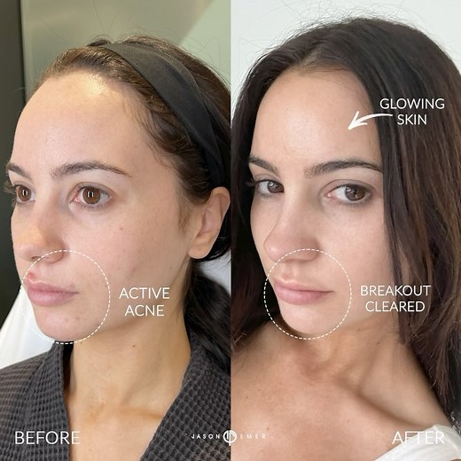 3.7K views · 18 comments | MODELS NEED LASERS WITH NO DOWNTIME |...