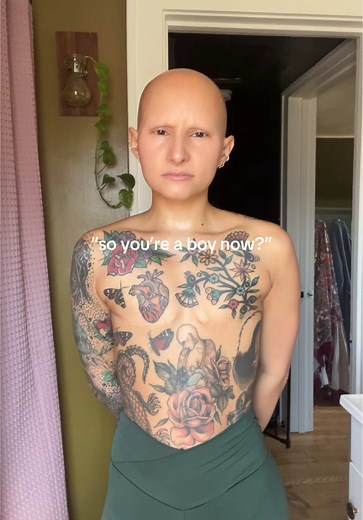 Woman with Alopecia & Mastectomy Shares Body Transformation