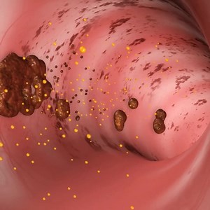 👩‍⚕️El curar tus Reflujos Acidos y Malestares Estomacales Ahora es mas FACIL con el 1, 2, 3 de Asu Labs! 1️⃣ Toma una capsula al dia 2️⃣ Disfruta de tus comidas favoritas 3️⃣ Deja que Asu Labs se encargue de tu digestión 💡Llevate el tuyo ahora con: ✅Envio Gratuito🚚 y ✅Garantia De 60 Dias 🔒 Con el 1, 2, 3 Disfruta Ahora Sin Estres.🥳 ⬇️Comprar Aqui⬇️ https://bit.ly/3Gw7XWR | Asu Labs