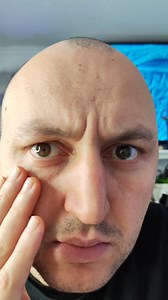 EYE UNDER A MICROSCOPE #science #microscope #microscopy #eye | Mir Glazami Microscopa