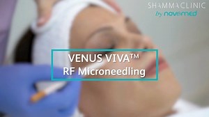 Venus Viva RF microneedling technology A non-surgical solution for...