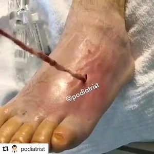 😨😷 | General Nursing Students