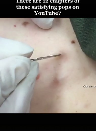 Sandra Lee, MD on TikTok