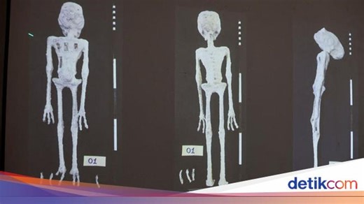 Kontroversi 'Mumi Alien' di Peru, Sidik Jarinya Disebut Tak Cocok dengan Manusia
