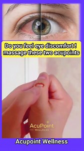 317K views · 6.5K reactions | Do you feel eye discomfort ! massage these two acupoints #DryEyeRelief #eyes #eyehealth #acupressure #eyeacupoint | Acupoint Wellness | Facebook