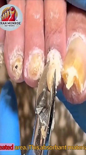 Innovative At-Home Foot Solutions #seniorhealth #footcare #gentlehealth | Fran Monroe